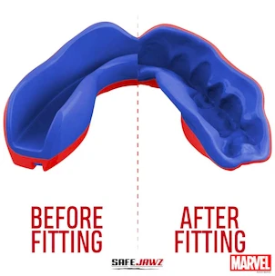 Chránič zubů SAFEJAWZ  Marvel Spider Man Senior